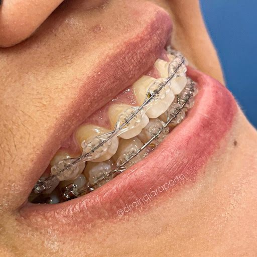 Dra Indiara Porto - Dentista em Teófilo Otoni/MG