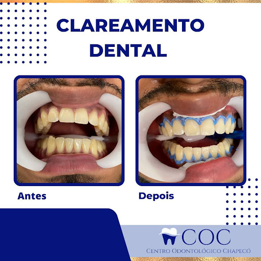 COC - Centro Odontológico Chapecó